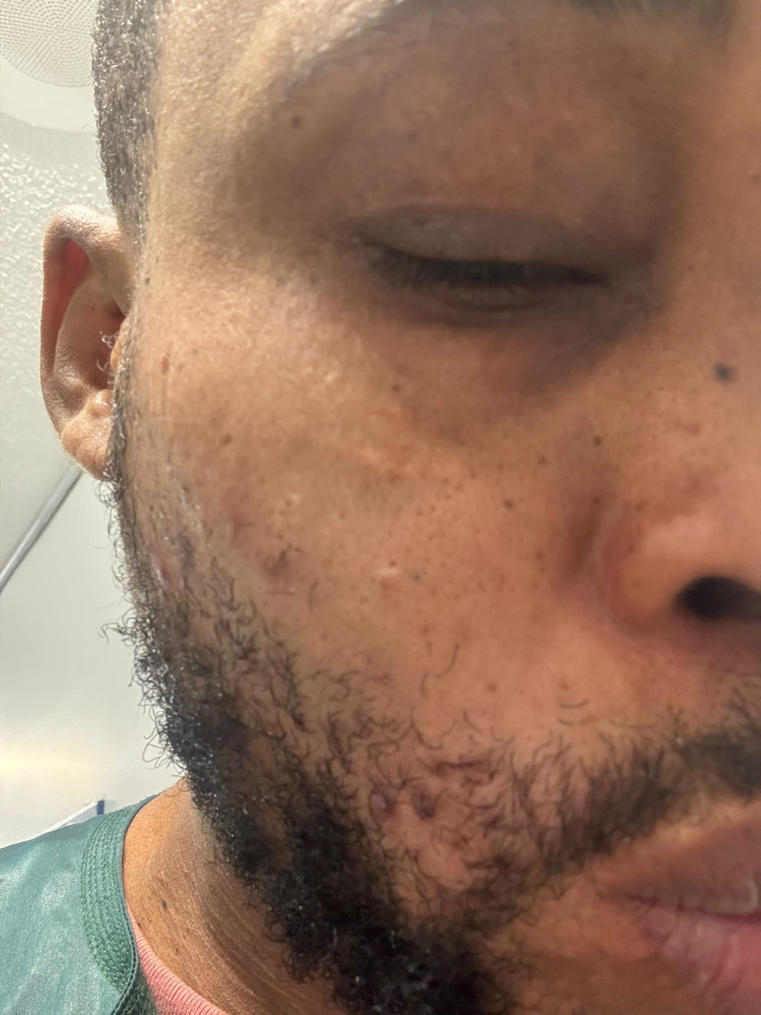 Bisexual Man Flees Town For His Safety